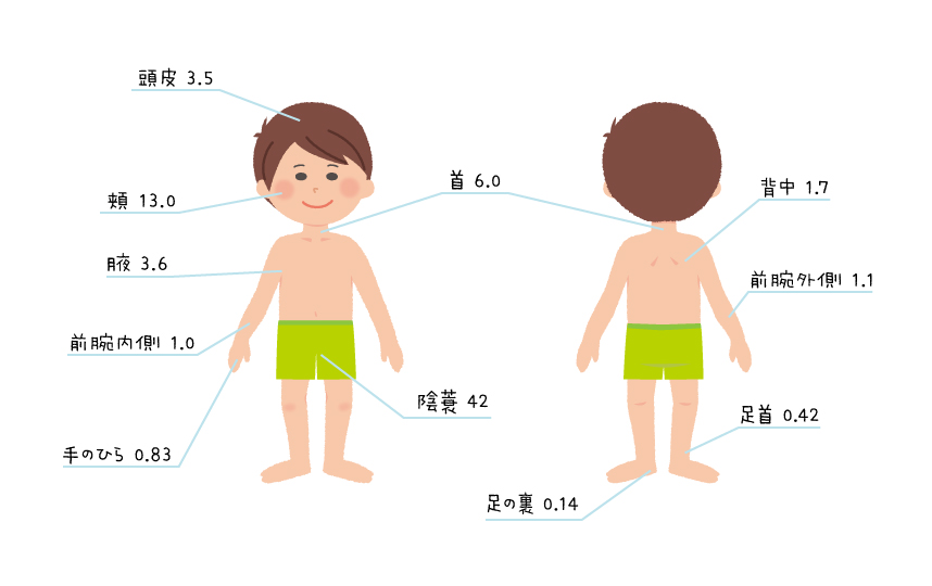 アトピー性皮膚炎