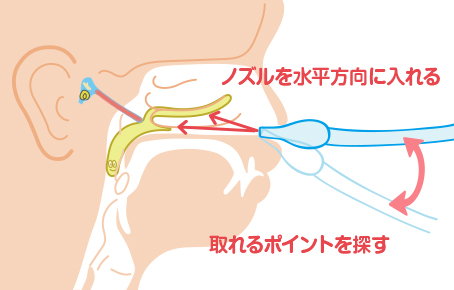 鼻 の 奥 の 鼻水 取り 方