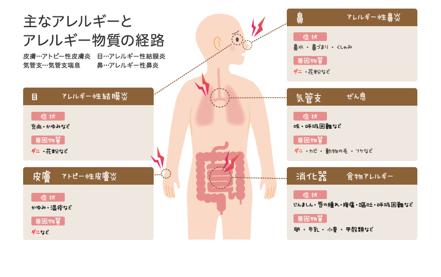 アレルギー 肌荒れ 小麦