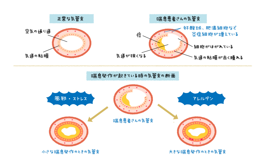 ダニアレルギー