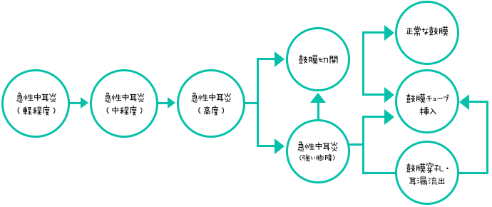 急性中耳炎 進行フロー