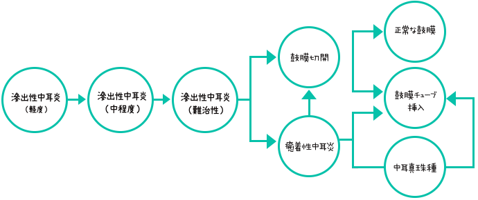 滲出性中耳炎 進行フロー