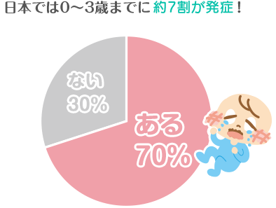 日本では0～3歳までに約7割が発症！